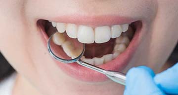 כיצד ניתן להיזהר מרשלנות רפואית בטיפולי שיניים?